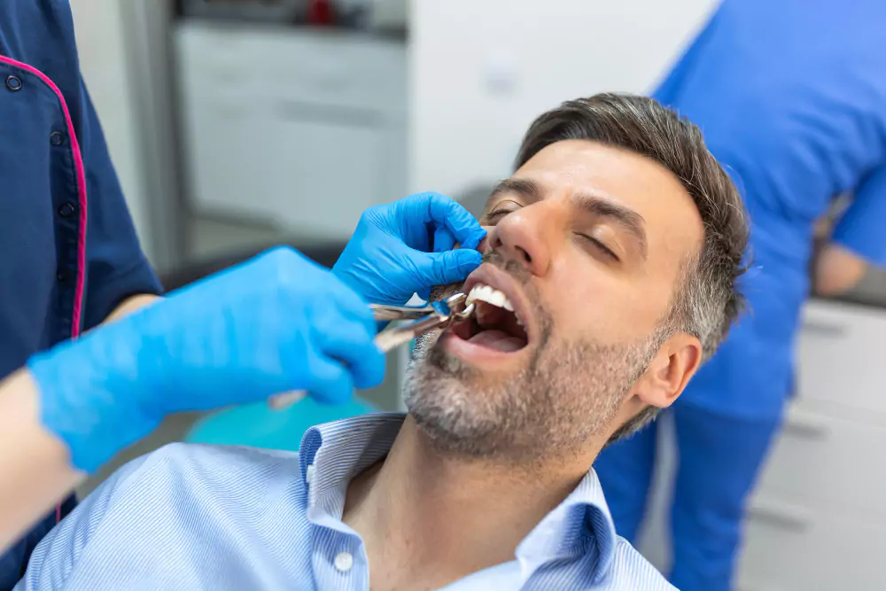 Tooth Extractions